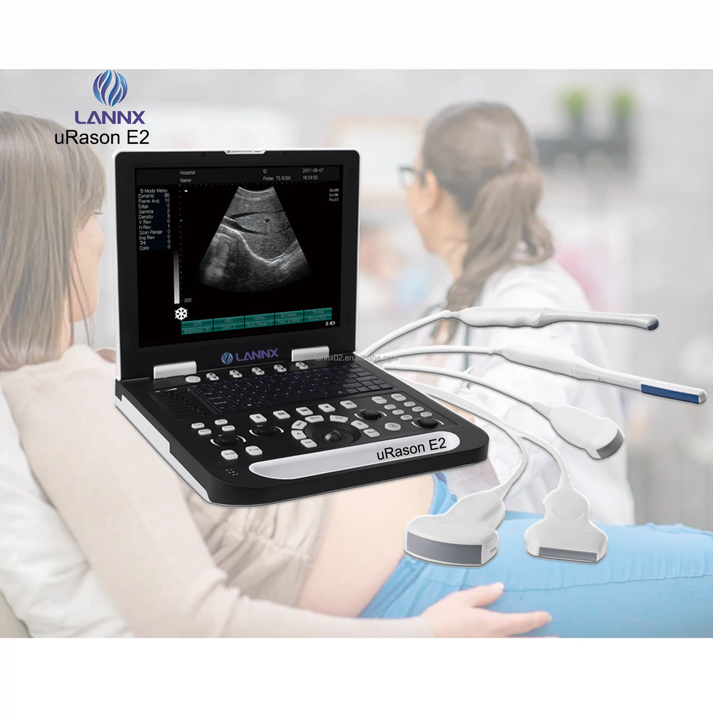 LANNX uRason E2 Clinic Handheld Ultrasound imaging detector Machine echocardiography for GYN/OB use examination scanner USG