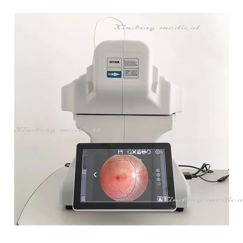 RC650b Ophthalmic Diagnosis Non Mydriatic Digital Retinal Fundus Camera with Ffa Function