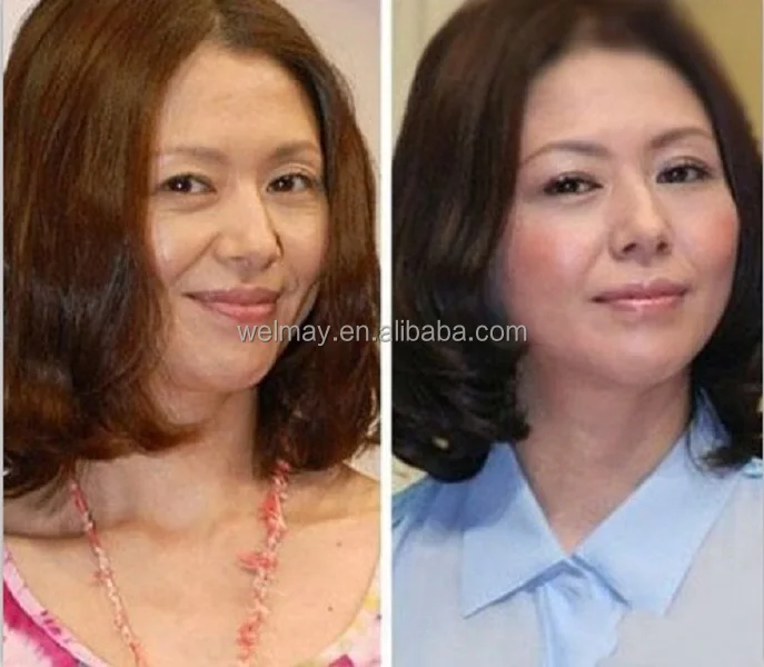 7 Tips 1MHZ RF Radio Frequency Machine Monopolar RF Face Skin Tightening Radio Frequency Ablation Beauty Device