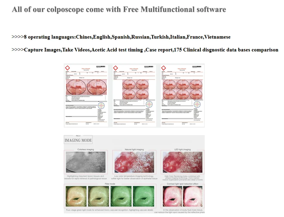 China Supplier CE Passed Colposcope Gynecology Examination Optical Colposcopy colposcope Machine for Clinic