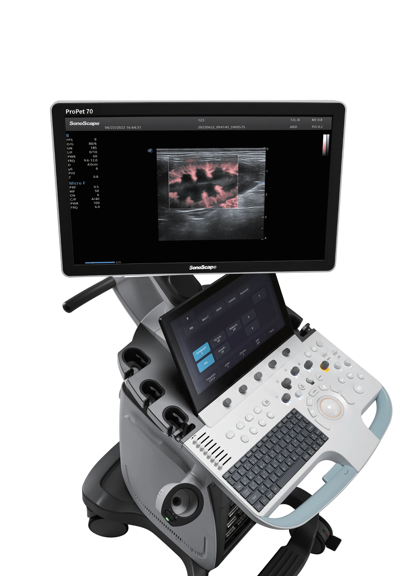 Новейший Ветеринарный ультразвуковой допплер Sonoscape Propet70 Cart с 256 элементами