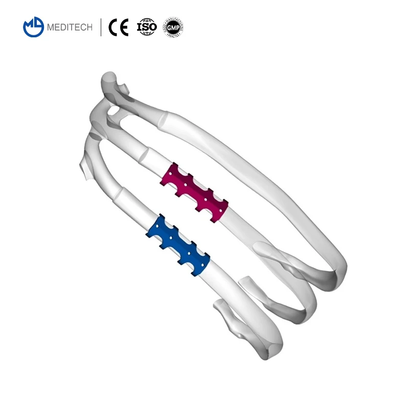 Orthopedic Titanium Patented Rib Bone Plate Ortho Implants For Rib Bone Fracture