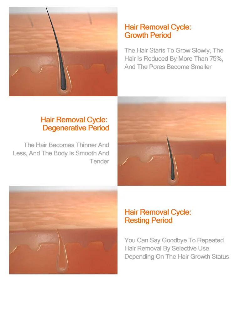 laser painless portable depilation hair removal 808nm diode laser machine 808 755 1064 diode laser for sale