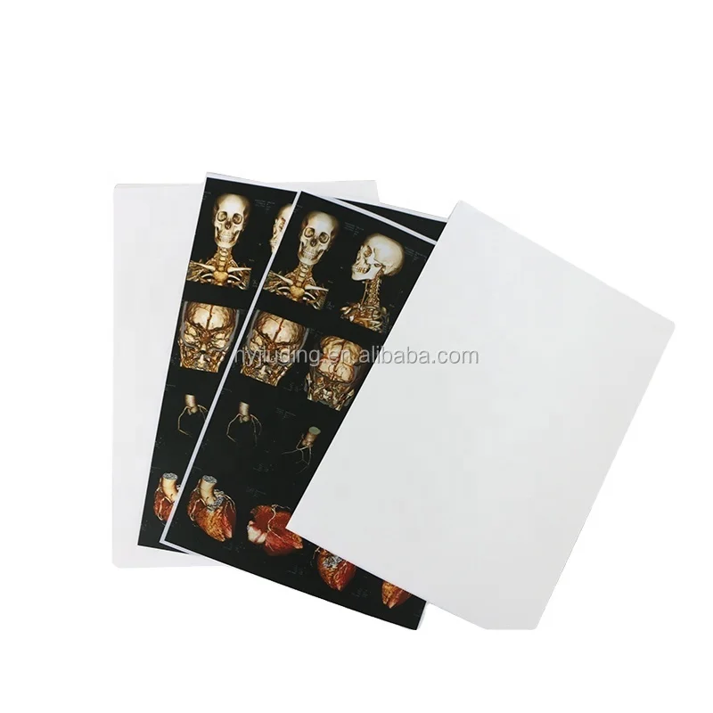 White Opaque Laser Medical X-ray Film Ultrasound Image Output Medical Dry Film