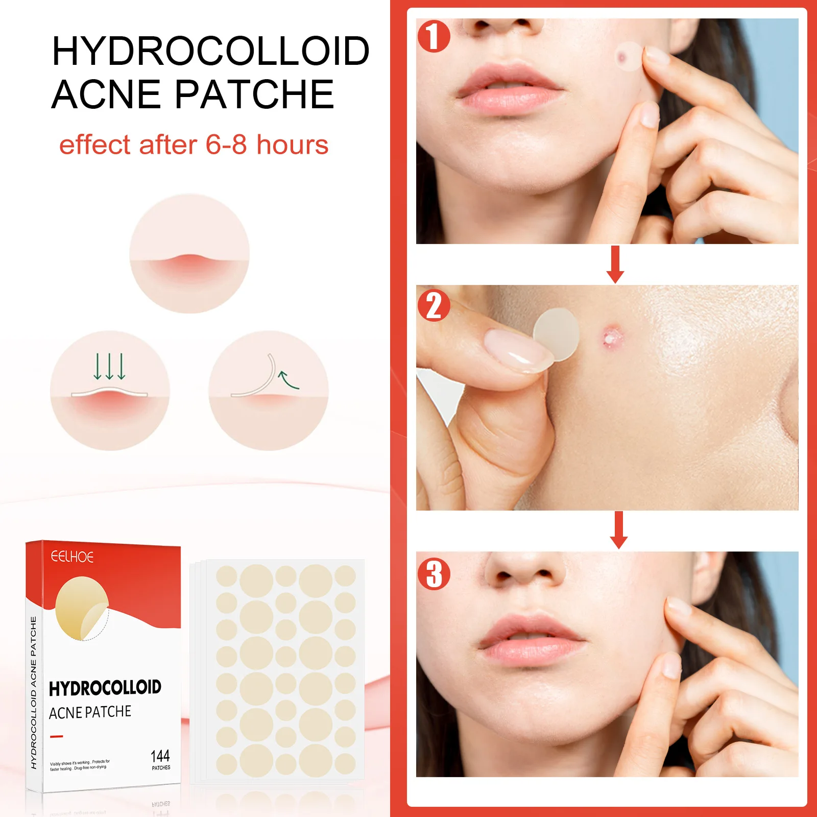 Safe skin protection and effective skin cleaning good quality hydrocolloid 144pcs/box acne patch