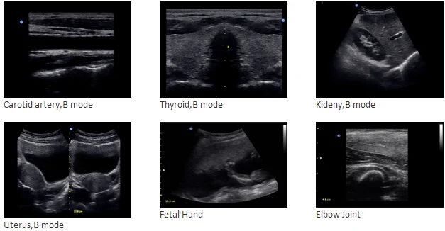 JM-806H Diagnostic Ultrasound System 2D ultrasound Imaging Ultrasonic Machine
