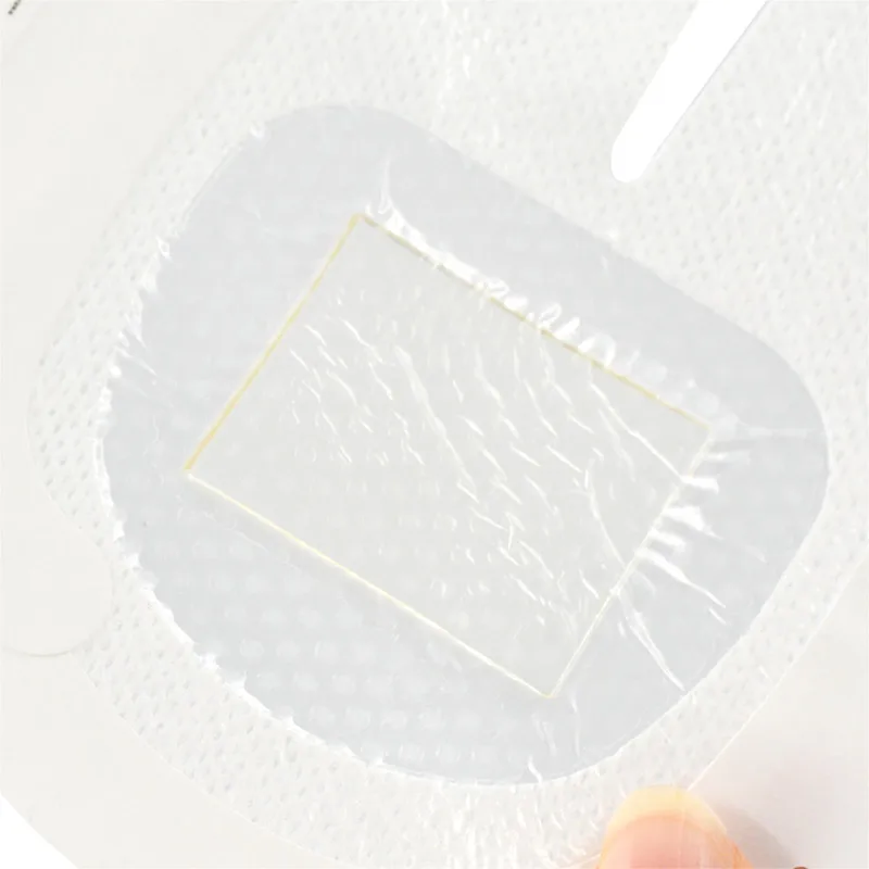 CHG IV dressing CHG Chlorhexidine Gluconate I.V. Securement Dressing
