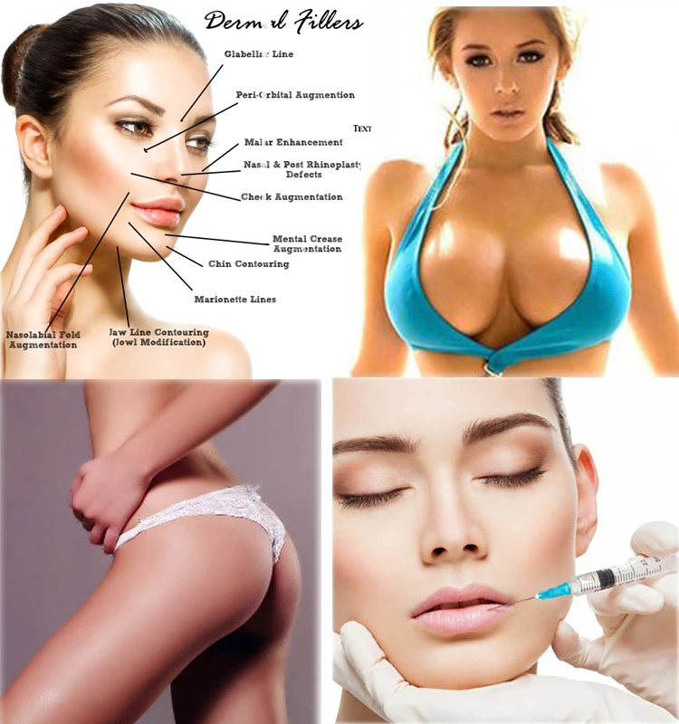 Heremefill Butt Enhancing Injections Buttock Enlarge Hyaluronic Acid Filler Injection 20ml