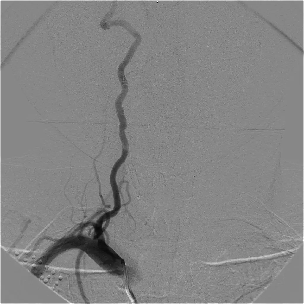 ORICH MEDICAL With Wholesale OX-C500 Surgical C-arm with High Power Generator Manufacturer