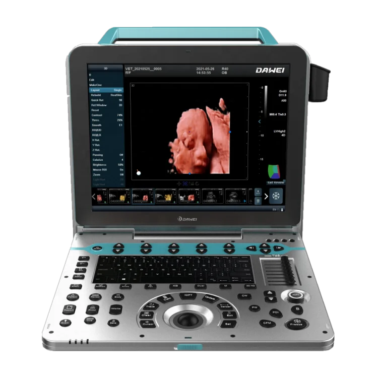 Perfect Obstetric Assistant DW-P50 4D Portable Ultrasound Ultrasonic Scanner Machines with Color Doppler for Sale