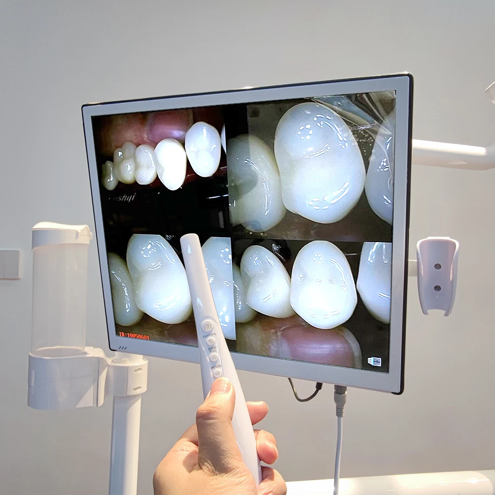 AliGan Dental equipment 17 inch 1280 x 1024 Resolution Wifi transmission Dental endoscopy system