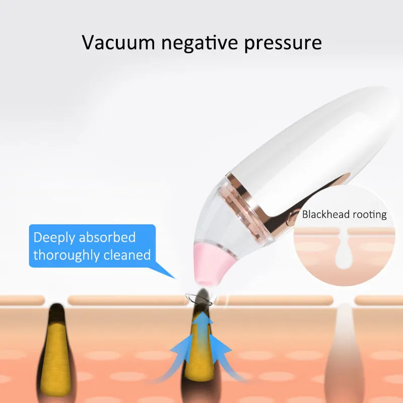 Dropshipping New Electric Black Head Remover Face Vacuum Cleaner Electronic Cleansing Skin Spots Removal Pore Cleaner Instrument