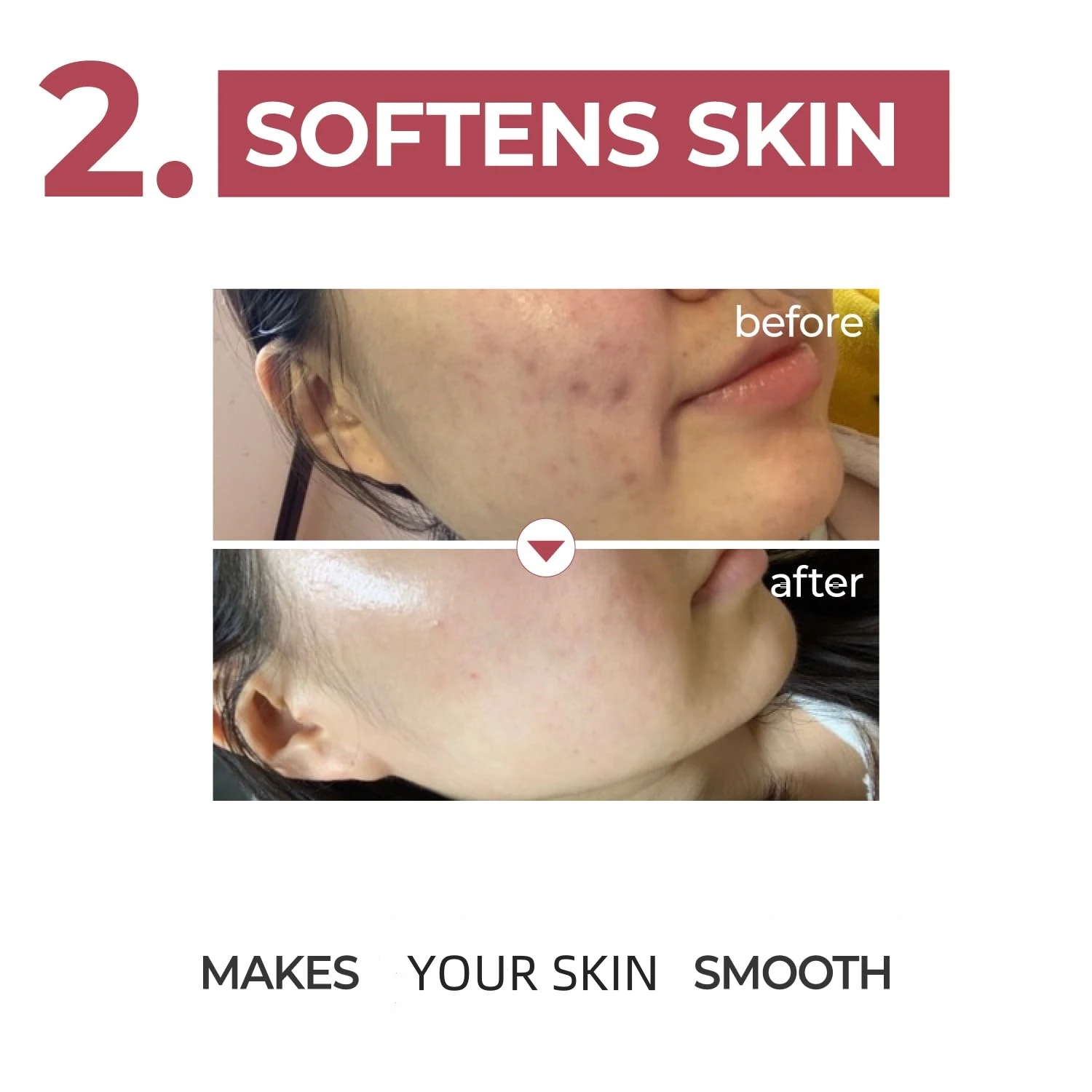 Natural Ingredients Niacinamide Smoothing Glow Skin Pore Care Textured Softening Serum For Face