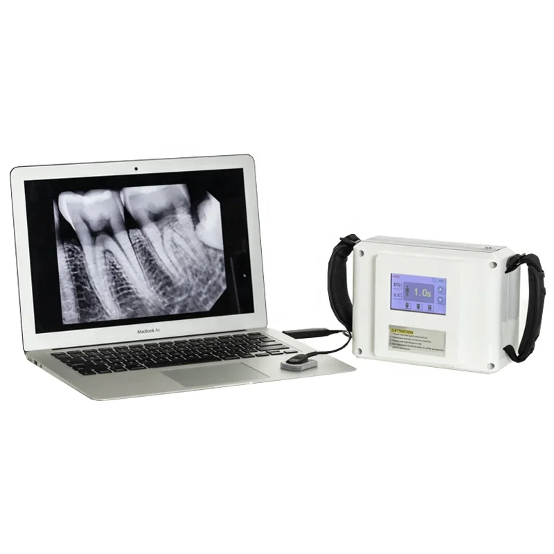 ZOGEAR XS-1000N Прочее стоматологическое оборудование Портативная система рентгеновского аппарата