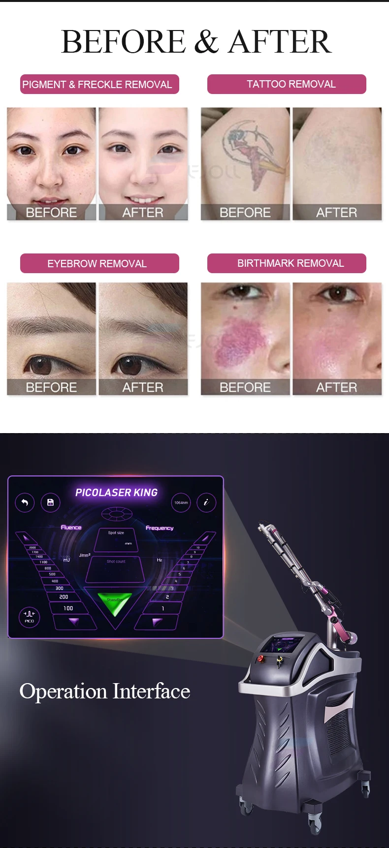 Hot Sale!!! Professional 450ps Picolaser Picosecond Laser Q Switched Nd Yag Laser Tattoo Removal Machine