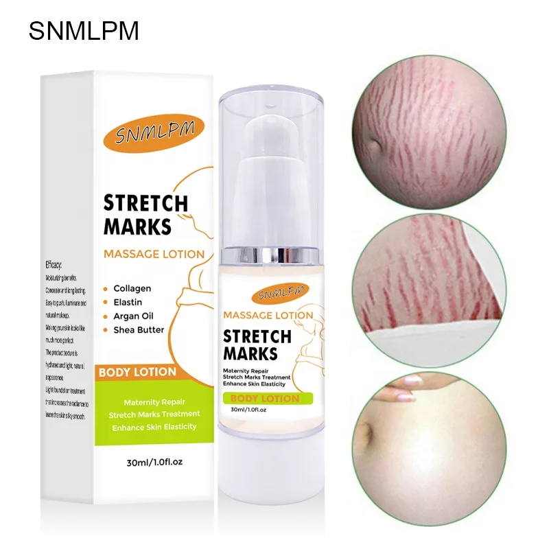 New Private Label Effective Original Organic Skin Repair Revitalizer Body Scar Remover Gel Pregnancy Stretch Mark Removal Cream