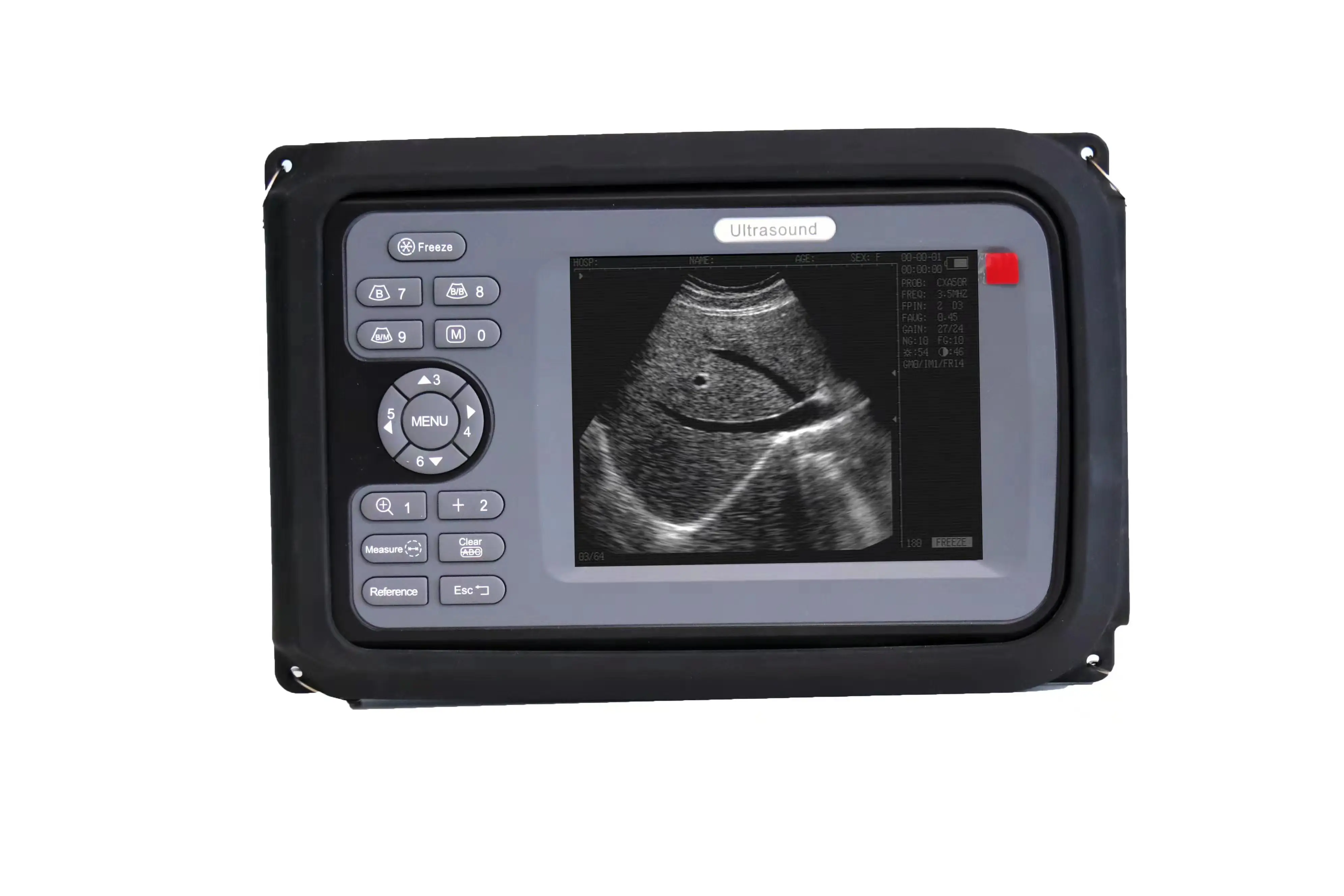 USB Rectal Horse Cattle Cow Bovine Equine Pregnancy Test Ultrasound Machine for Veterinary Use
