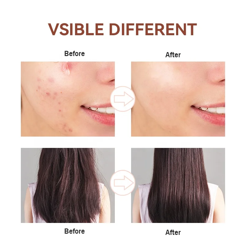 4 in 1 Professional Handheld Acne Treatment Facial Lift Skin Tightening High Frequency Skin Therapy Machine Skin Therapy Wand