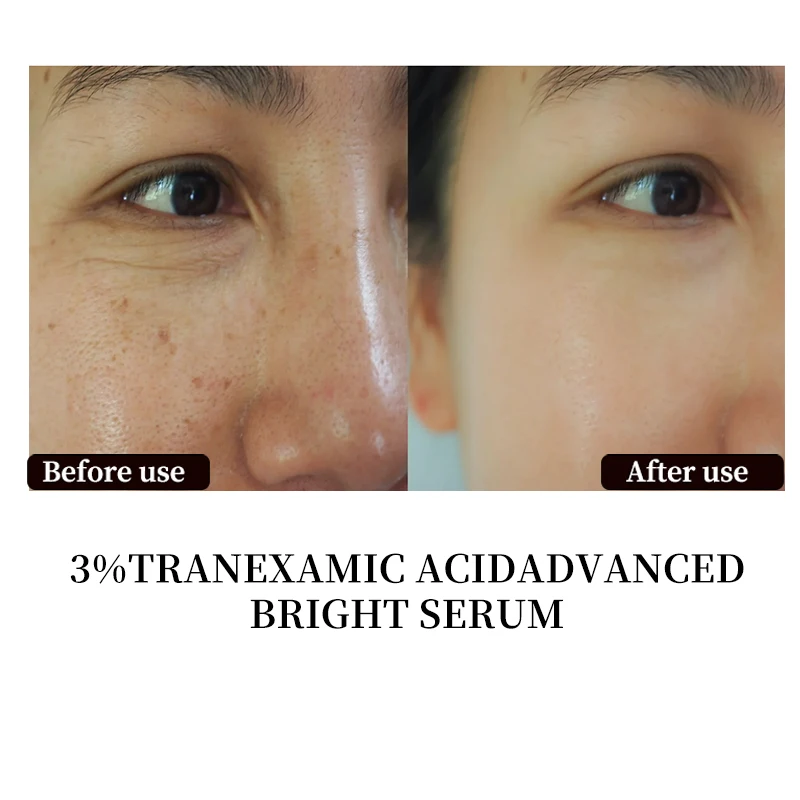 Wholesale Organic Best Face Serum Glowing Hyaluronic Vitamin C Wrinkle Acne Alpha  Stem Cell Microneedling Tranexamic Acid Serum