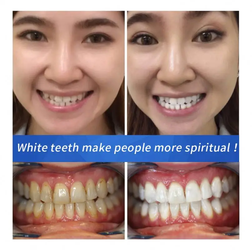 100% Natural organic Bentonite Clay  Charcoal Tooth Powder Brands Charcoal Tooth Whitening Powder