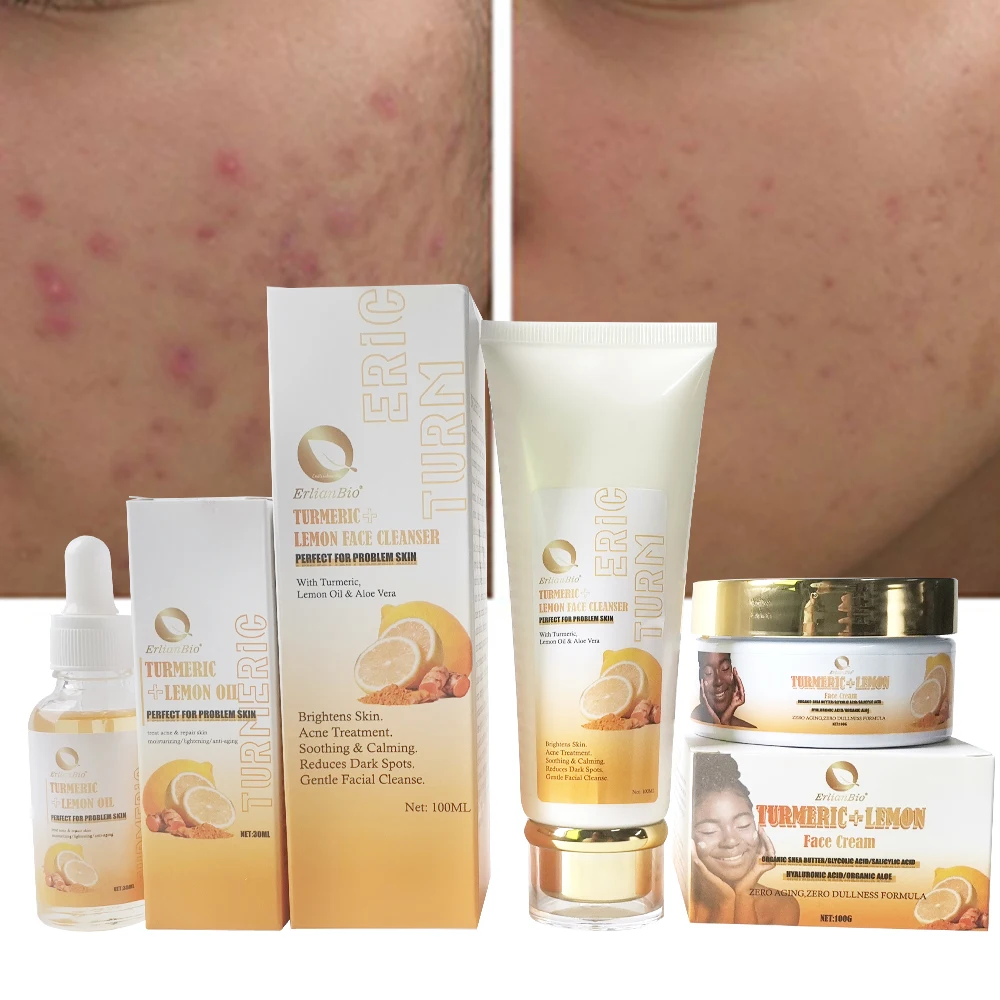 Turmeric Brightening Skin Set Acne Spot Removal Facial Cleaning Moisturizing Serum Cream Face Cleansing  Skincare Set