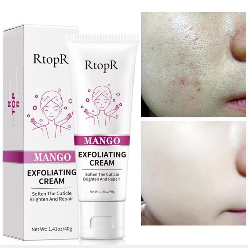 Face Exfoliating Cream Skin Care Whitening Moisturizer Repair Facial Scrub Cleaner Acne Blackhead Treatment Remove Face Cream