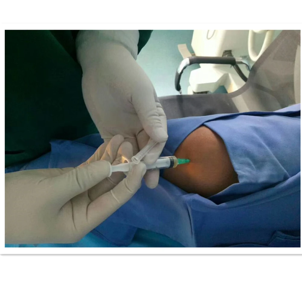 Hospital Medical Supplies prp acd gel, prp rich plasma, high quality prp tube for knee