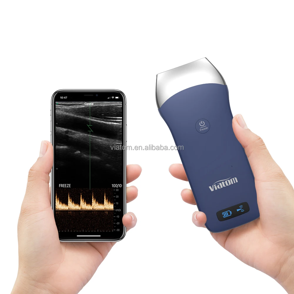 MSK ultrasound can effectively diagnose muscle pathology by providing real-time imaging,dynamic evaluation of muscle contraction