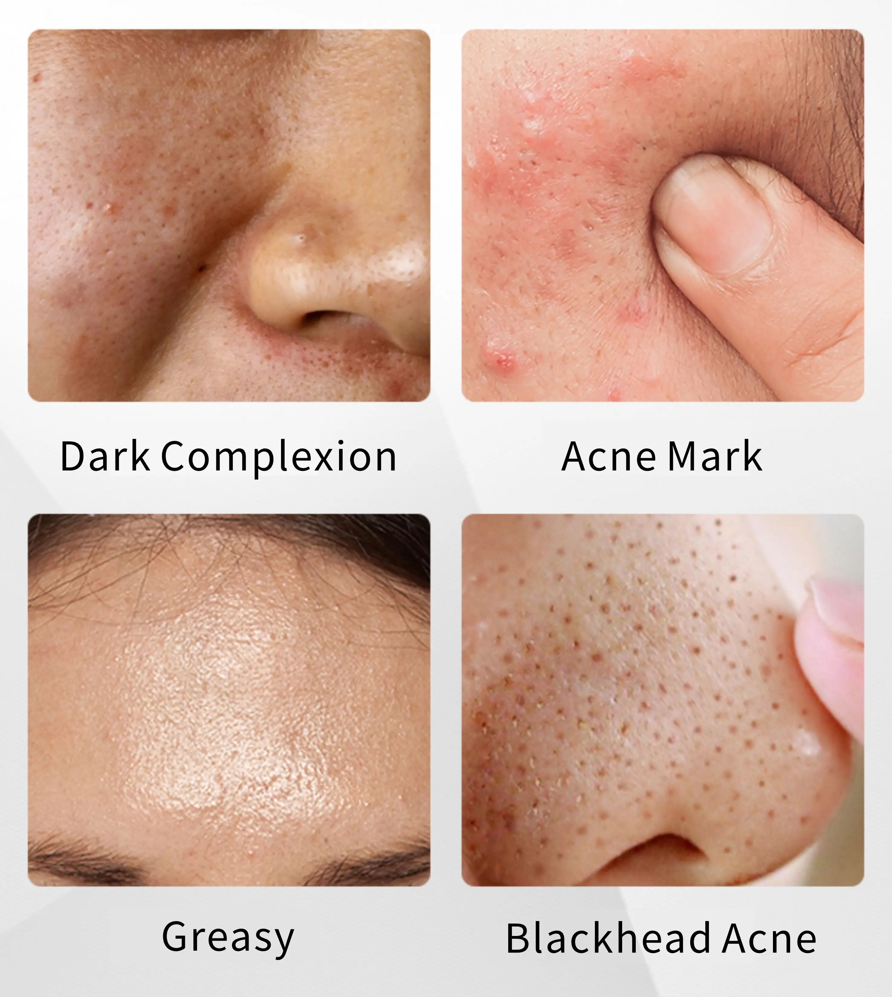 OEM ODM Acne Removal Face Cleanser Hyaluronic Acid And Nicotinamide Foaming Face Wash