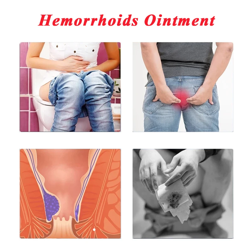 Hemorrhoids Ointment Internal External Anal Fissure Piles Pain Relief Cream Hemorrhoid Bleeding Swelling Relieve Balm 20g