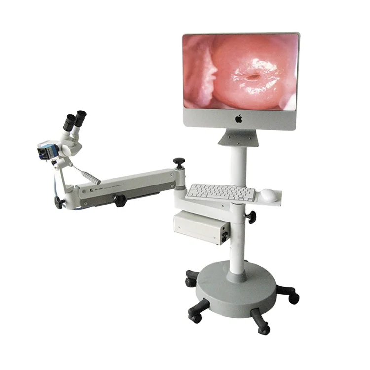 China Supplier Colposcope Gynecology Examination Optical Colposcopio for Clinic