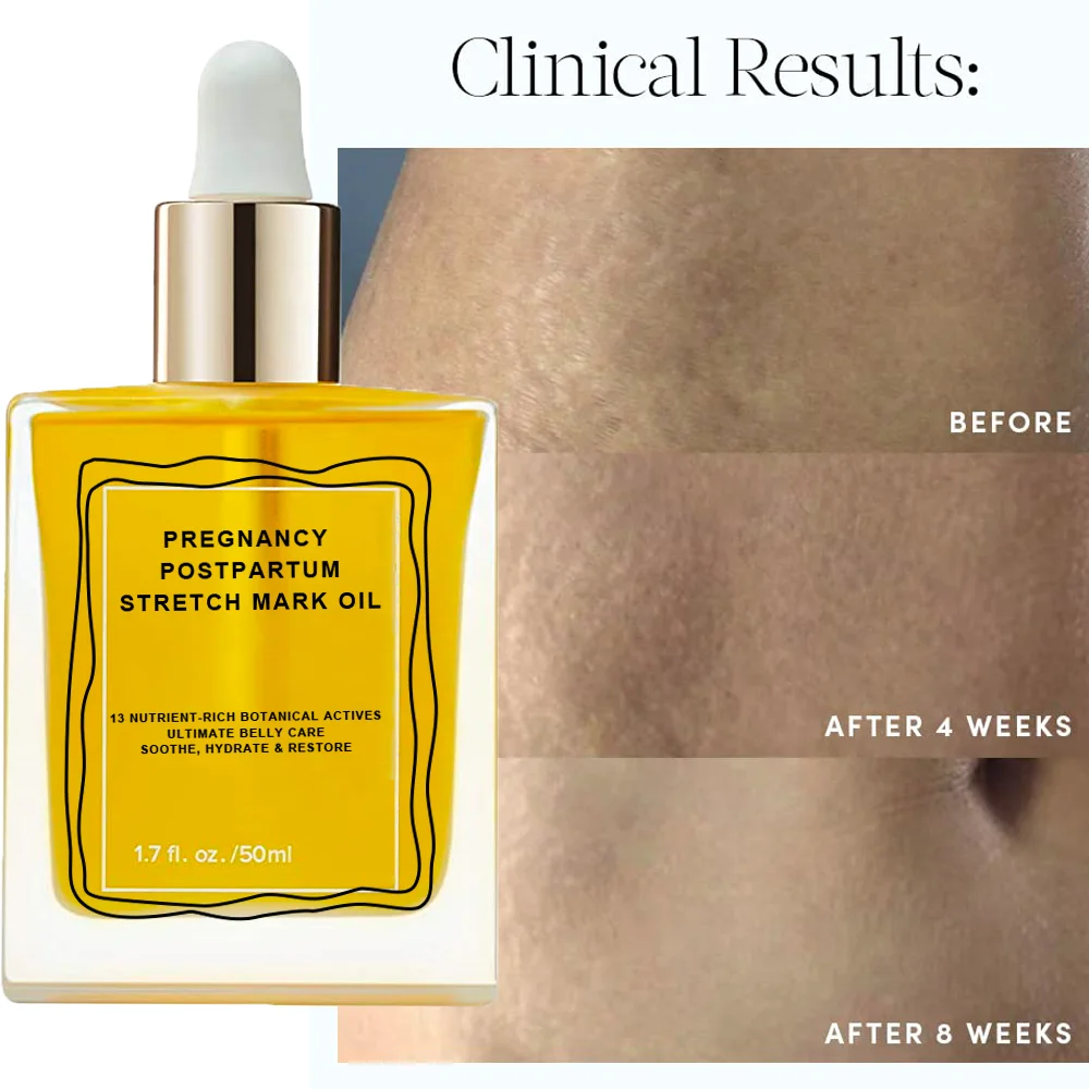 HOT Firming Moisturizing Belly Serum Pregnancy Postpartum Bio Oil Stretch Marks Tummy Butter Dry Itchy Skin Relief Soother