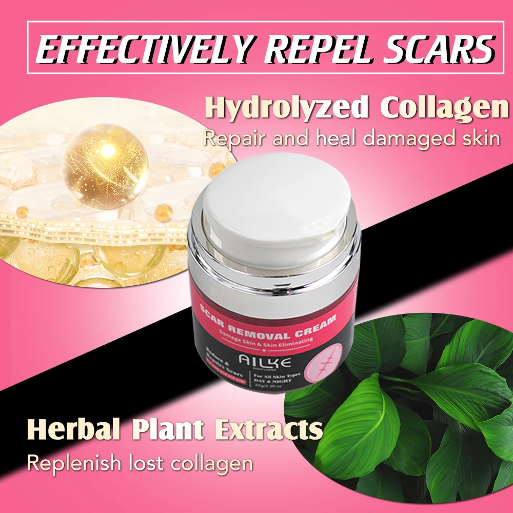 Strong Effective Acne Scar Removal Cream Smoothing Firming New Scars Stretch Marks Pimples Treatment Cream