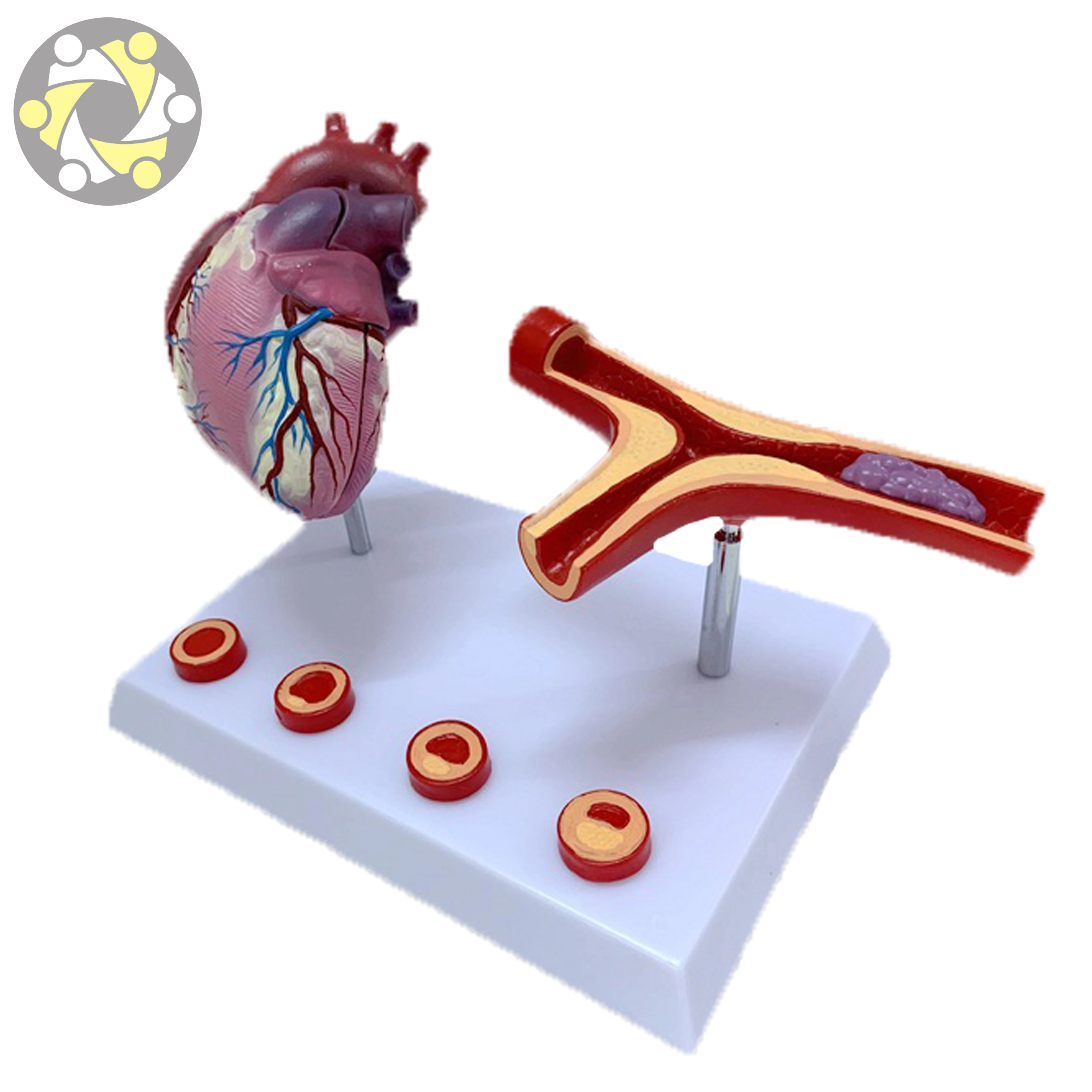 Hospital School Use Biological Disease Heart Model Heart Coronary Artery Heart Pathology