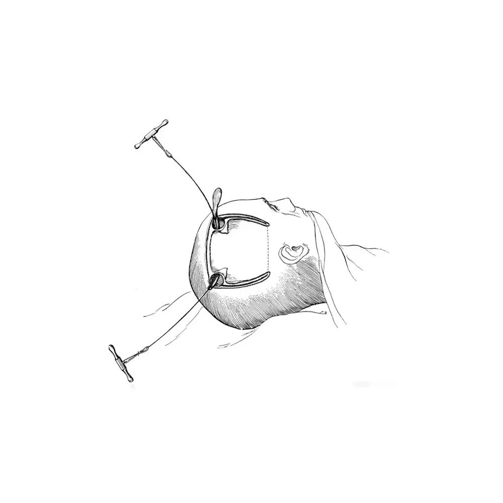 Surgical Instruments Neurosurgery Instruments Surgical Manual  Wire Saw Orthopedic Gigli saw