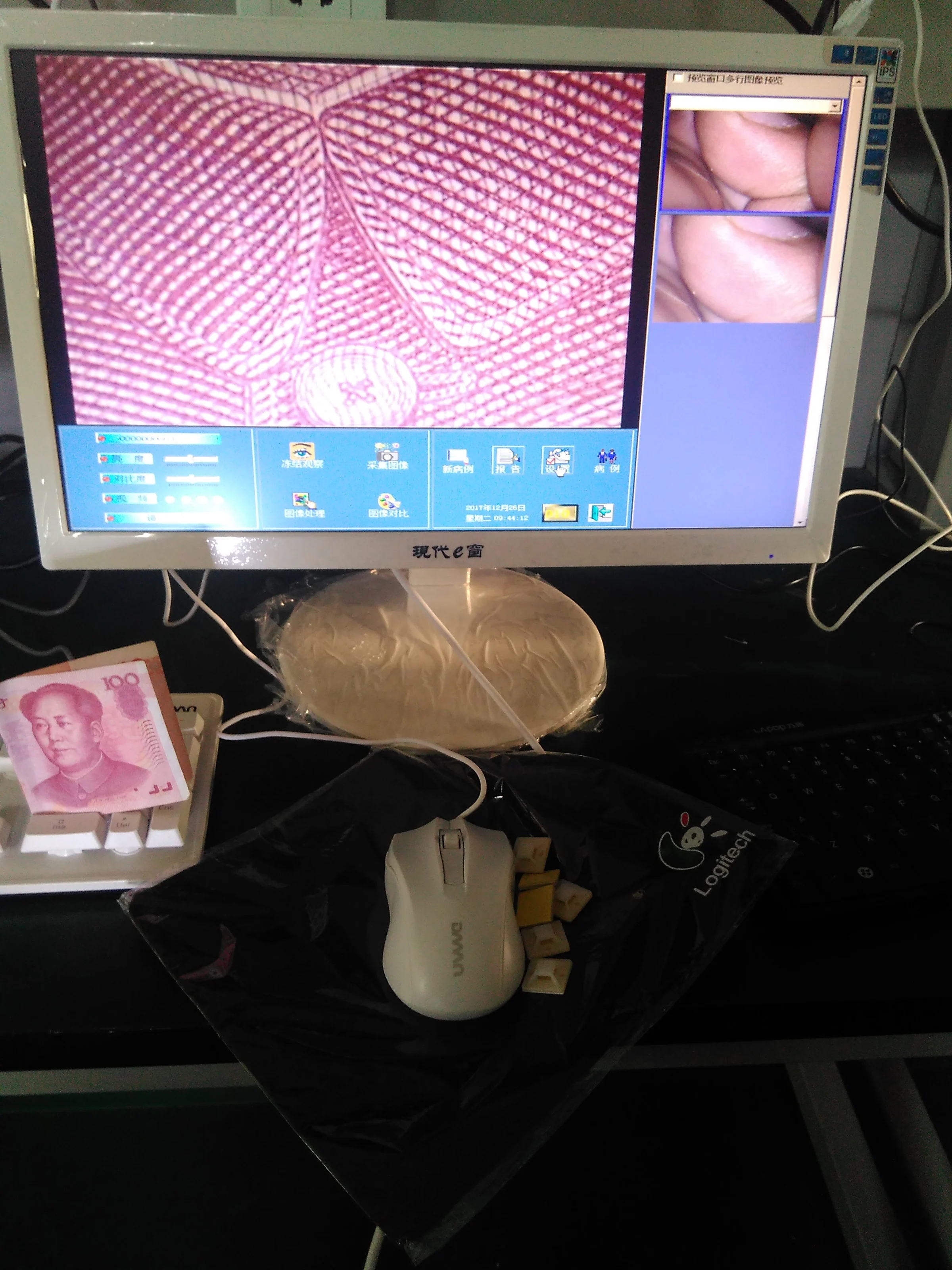 Medical portable handheld digital electronic video camera ccd sony colposcope