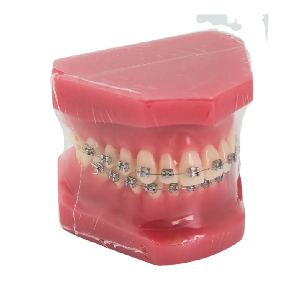 Dental Orthodontic Model Typodont With Metal Brackets