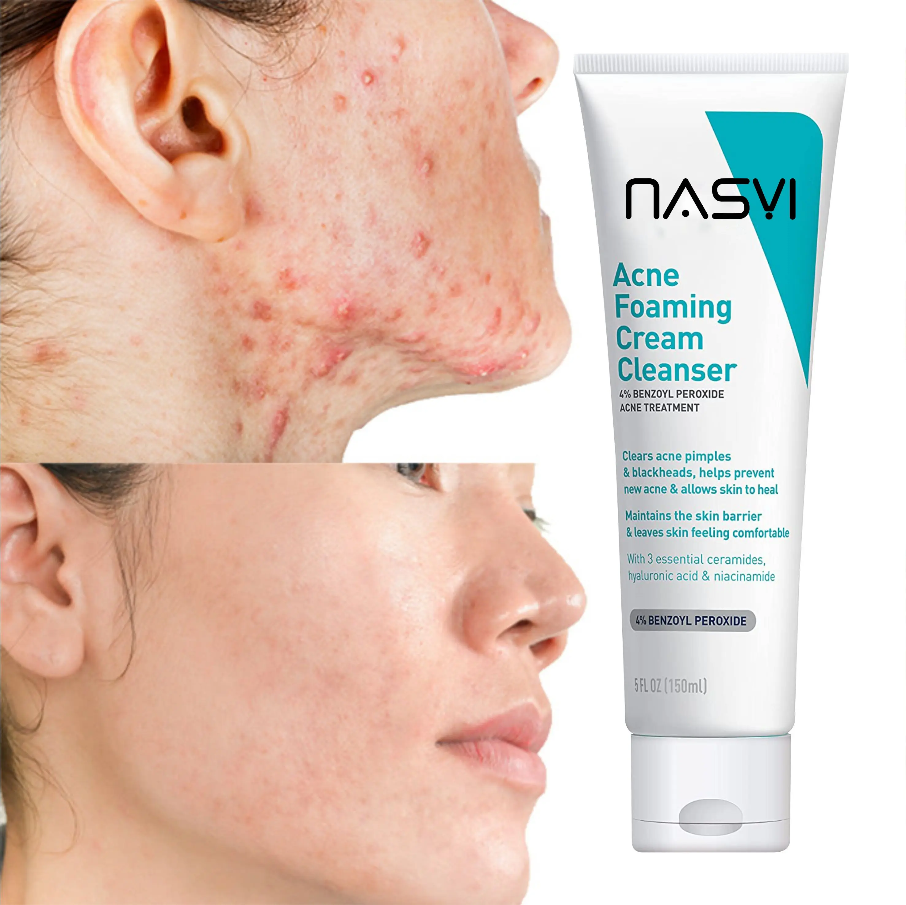 OEM ODM Acne Removal Face Cleanser Hyaluronic Acid And Nicotinamide Foaming Face Wash