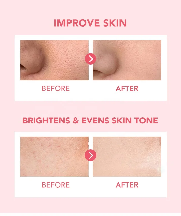 Niacinamide Face Cream Plastic Jars Face Cream For Glowing Skin No Side Effect Whitening Cream