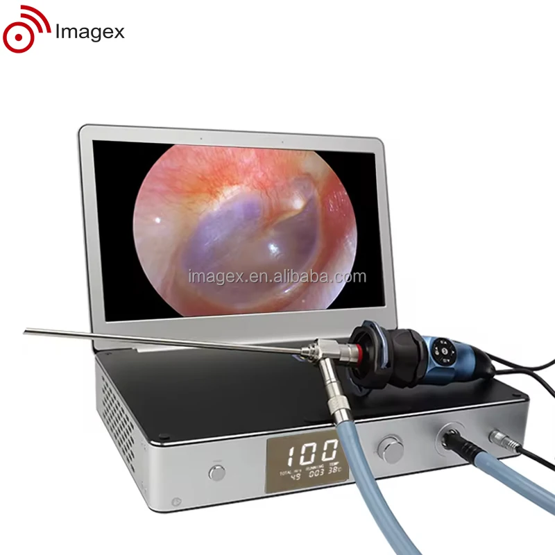 Tinyview 1000s all in one Medical Endoscopic Camera endoscopy System for Hospital Use
