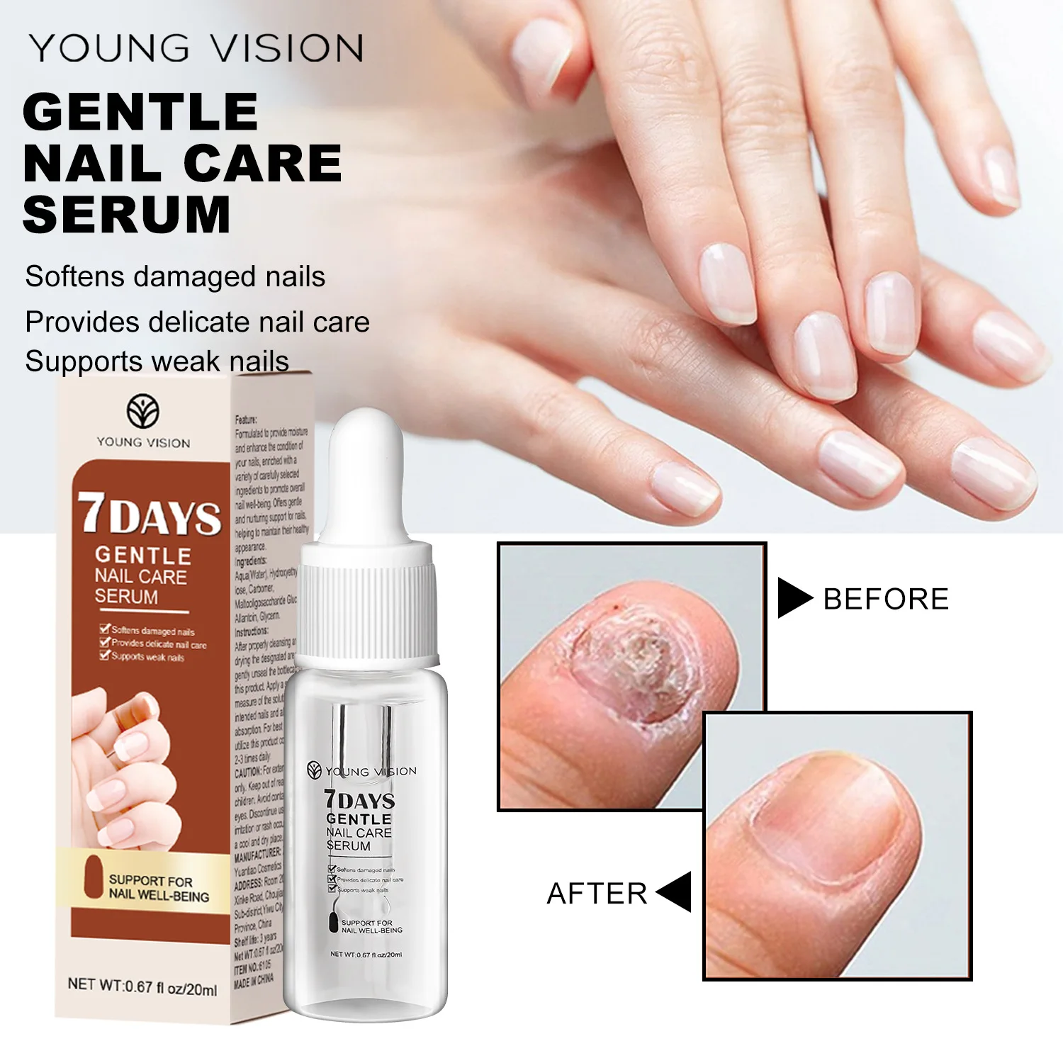 7 Days Gray Nail Repair Serum Solution for Hand and Foot Care Comprehensive Nail Repair Care
