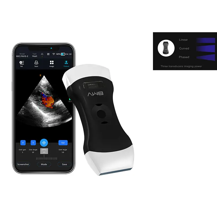Wireless 3 in 1 Phased probe And Linear probe Ultrasound Handheld Wireless Ultrasound Scanner