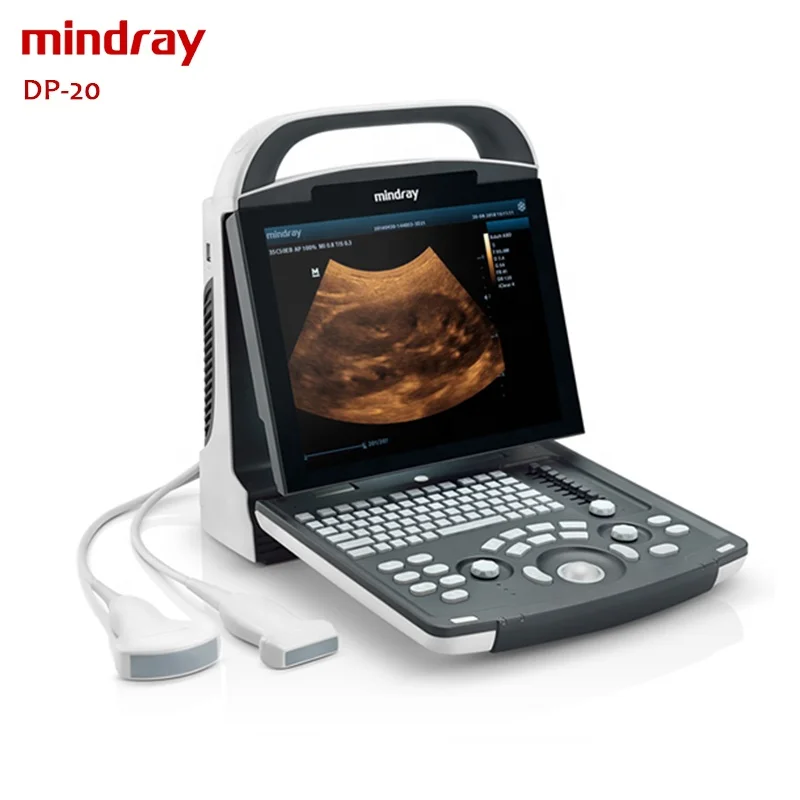 Mindray DP-20 портативный ультразвуковой цена УЗИ аппарат медицинское ультразвуковое оборудование для продажи