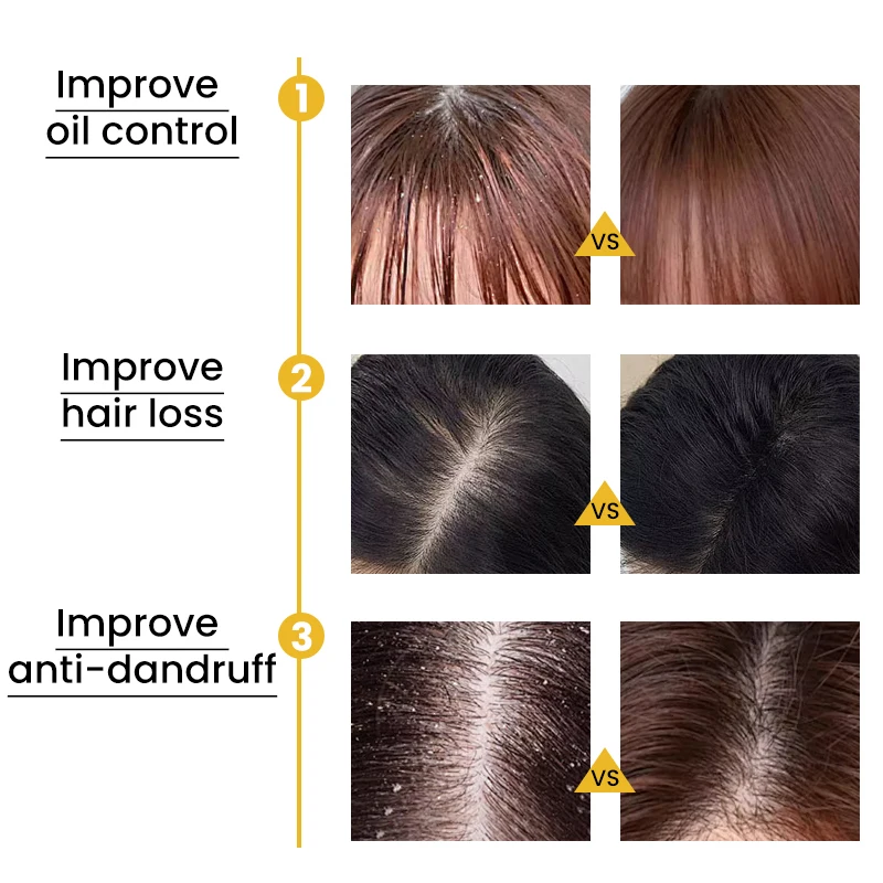 Zunrong wholesale private label OEM ODM salon 308g 710g herbal plant fresh ginger anti-break hair shampoo