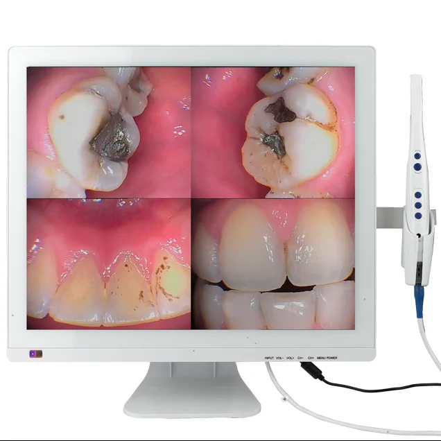 newest most sold M-978 wired intraoral cameras wireless dental camera monitors dental monitor