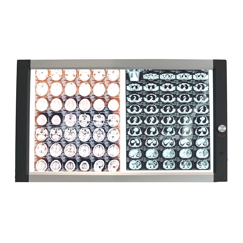 Micare DQ-2B 60w led double viewer  Hospital special orthopedic heart center X-ray source examination lamp