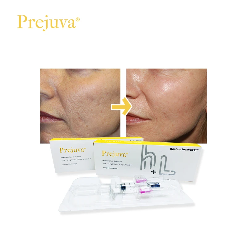 Prejuva Profhilo 32Mg Hyaluronic Acid Chin Cheek Dermal Filler Biomodeling With Profhilo Men