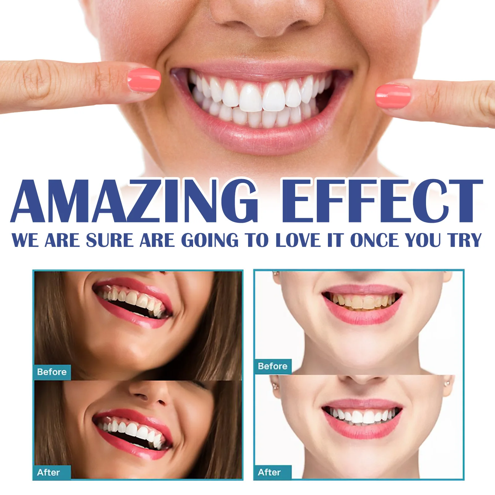 Gingival care gel relieves swelling pain of gingival receding clean stains whitening teeth Genuine wholesale price