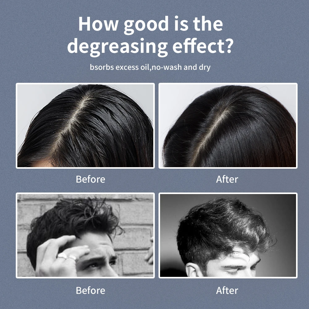 Immetee Free Sample White Color Dry Hair Powder Texture Powder Oil Control  Hair Powder For Man Hair Style