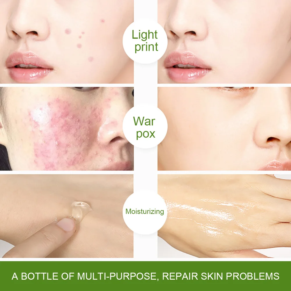 Korea private label best organic 100% pure natural extract moisturizing soothing after sun repair body face aloe vera gel